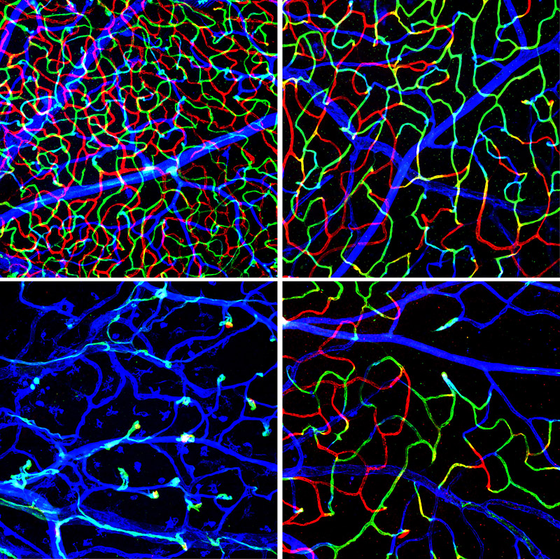 Figure 1: Retinal vascular defects in Norrin-deficient mice...